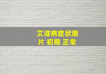 艾滋病症状图片 初期 正常